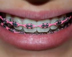 Power Chain
