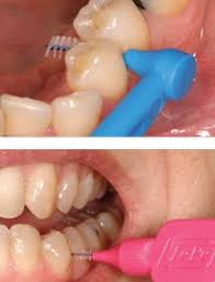 Interdental Tooth Brush