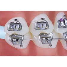 Buccal/Molar Tube